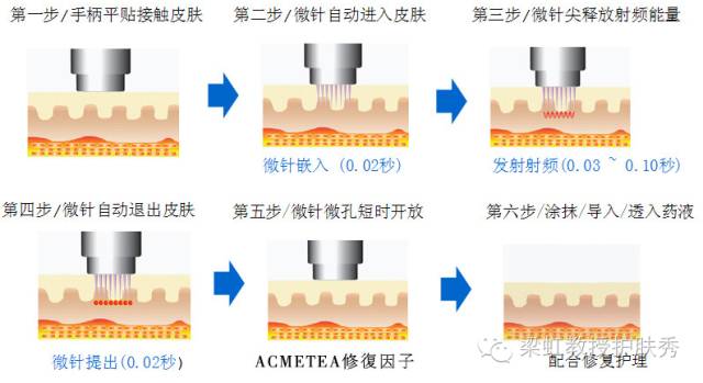 收缩毛孔省钱方法,收缩毛孔超级有效