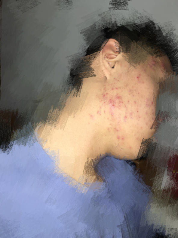 精准护肤问答,护肤问答每天解决一个小问题