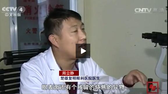 三星S6竟会喷火！险把小伙眼睛烧瞎，客服：伤处理不了！