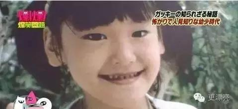 日本整形与韩国整形对比,为什么日本整形不如韩国整形