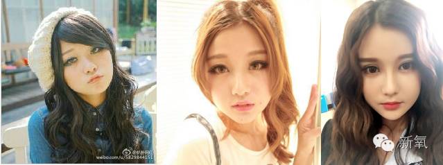 双眼皮变脸真实案例,网红双眼皮最成功的