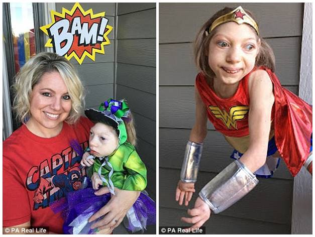 这位妈妈有两个患小头症的女儿，她家的画风是这样的