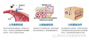 中国银屑病生物治疗专家共识2019,2020银屑病大会