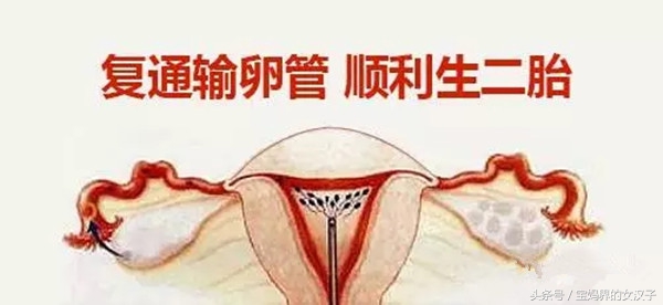 想生二胎怀不上要做哪些检查,准备要二胎了总是怀不上怎么办