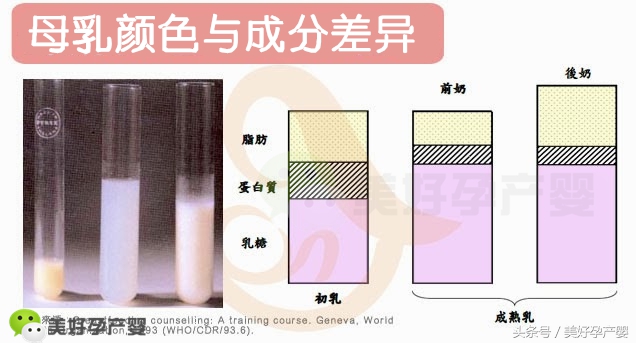 产妇母乳什么颜色正常,产后母乳颜色发黄怎么回事