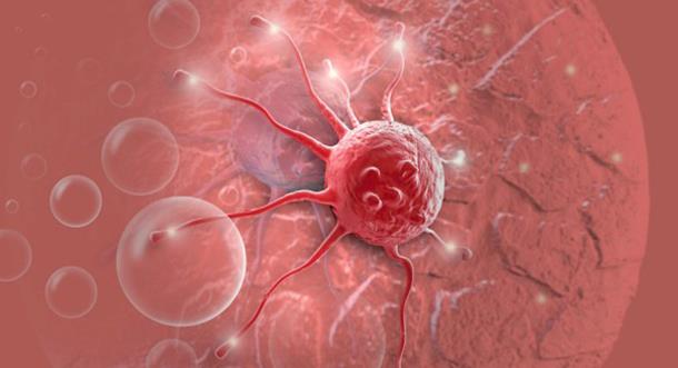 癌症的病理类型鳞癌和腺癌在身体各部位的分布特点