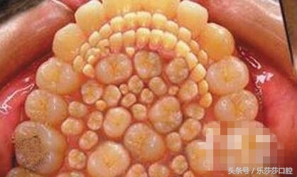 牙医能辨别出换过没换过的牙齿吗,牙医见过最好的牙齿是怎么样的