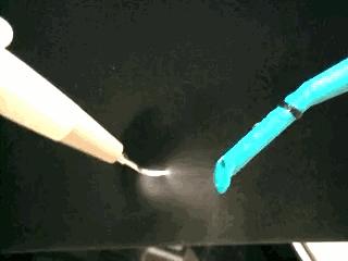 牙结石自己掉了一块超级臭,用手抠掉了一块牙结石