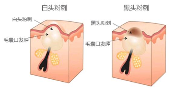 老赖死皮赖脸,老赖欠薪跑路怎么办