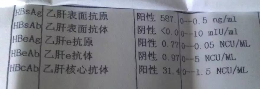 有小三阳可以打乙肝疫苗吗,乙肝小三阳要不要用药治疗