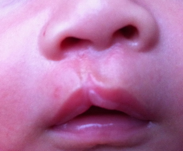 b超知识好不好学,b超要了解什么