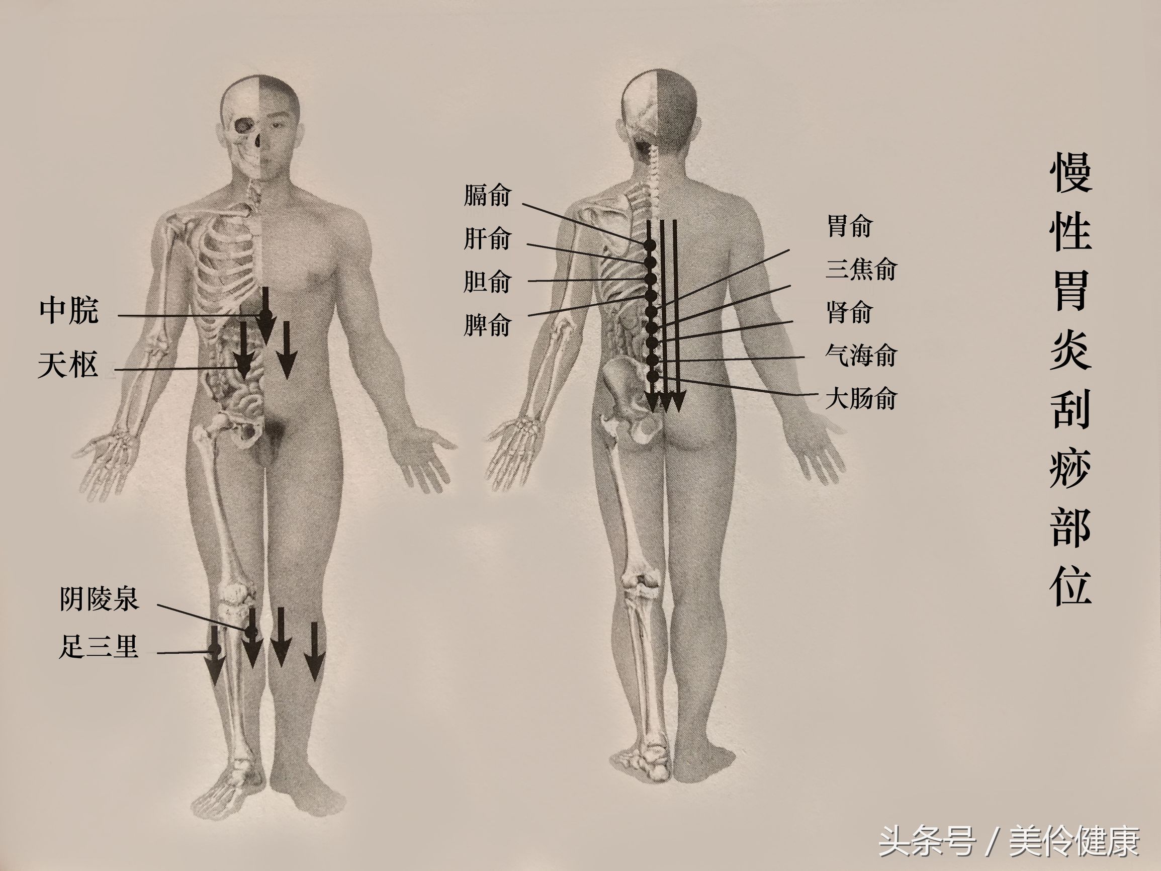 胃炎反复用药,胃炎反反复复发作吃什么中药