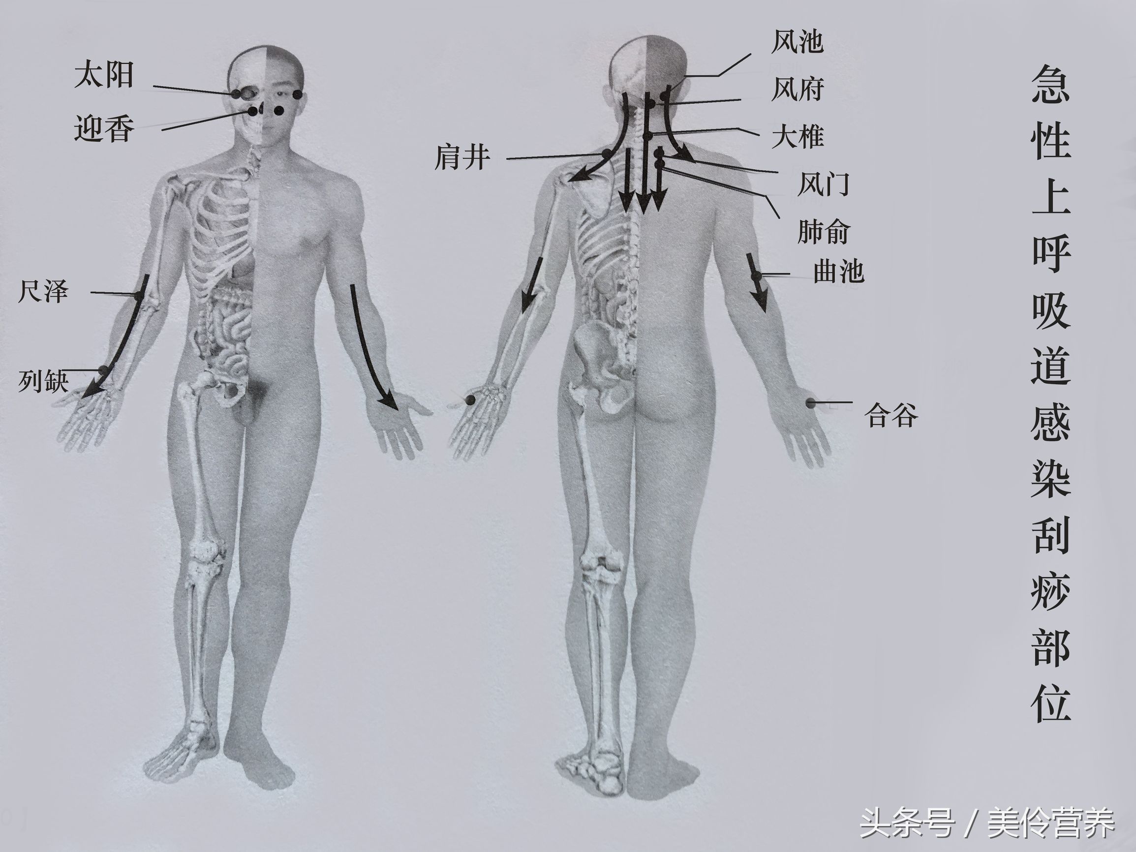 支气管炎穴位刮痧视频,支气管炎咳嗽刮痧哪里效果最快