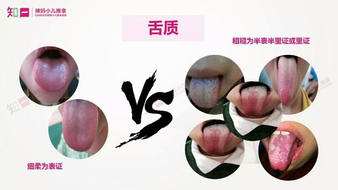 舌苔白厚是什么原因怎么检查,舌苔厚薄如何判断