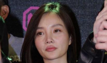 整容保质期大概多久,明星整容一般多久恢复