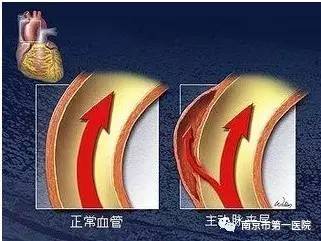 17岁少年心脏病手术,小女孩做了4次心脏手术