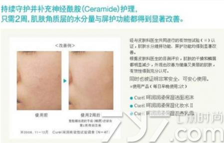 珂润面霜真假鉴别方法图片对比,珂润面霜官方鉴别真假图片对比