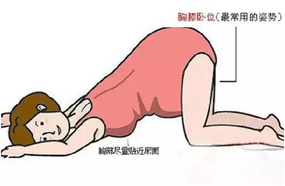 宝宝出生怎么睡觉姿势好,宝宝出生的姿势