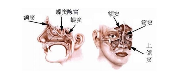 霉菌性上颌窦炎可以吃阿奇霉素,哪些生活习惯会引起霉菌性阴道炎