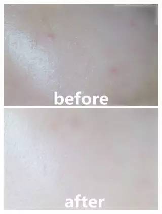 为什么你下重金护肤,却还是比不上她?