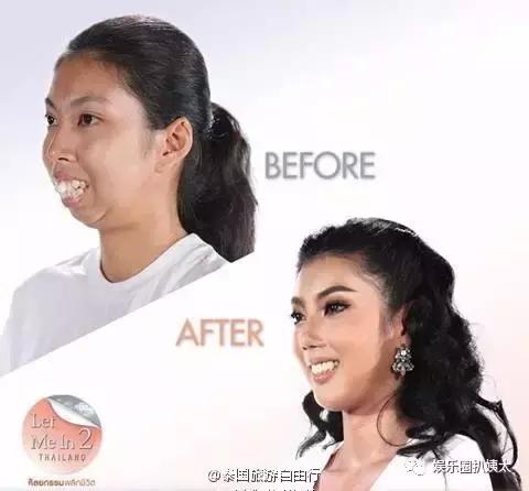 泰国专门的整容节目,泰国的整容节目有哪些