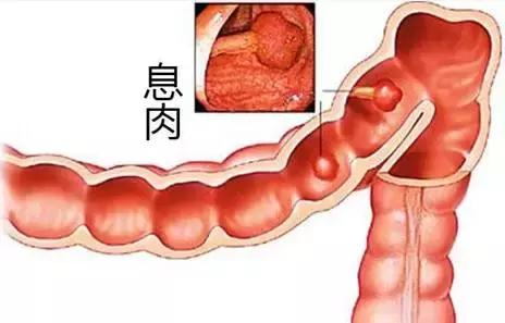 脸上长黄斑怎么检查,看脸上的斑如何知道什么病因