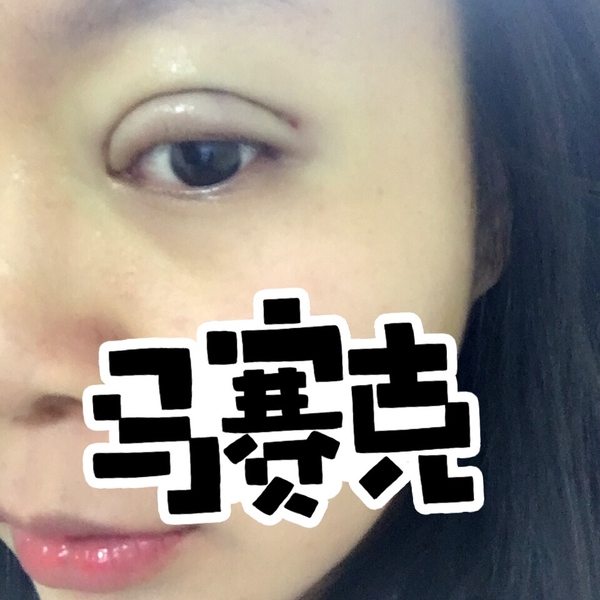 做完双眼皮眼睛像哭了一样,做完双眼皮哭了眼睛灰蒙蒙的