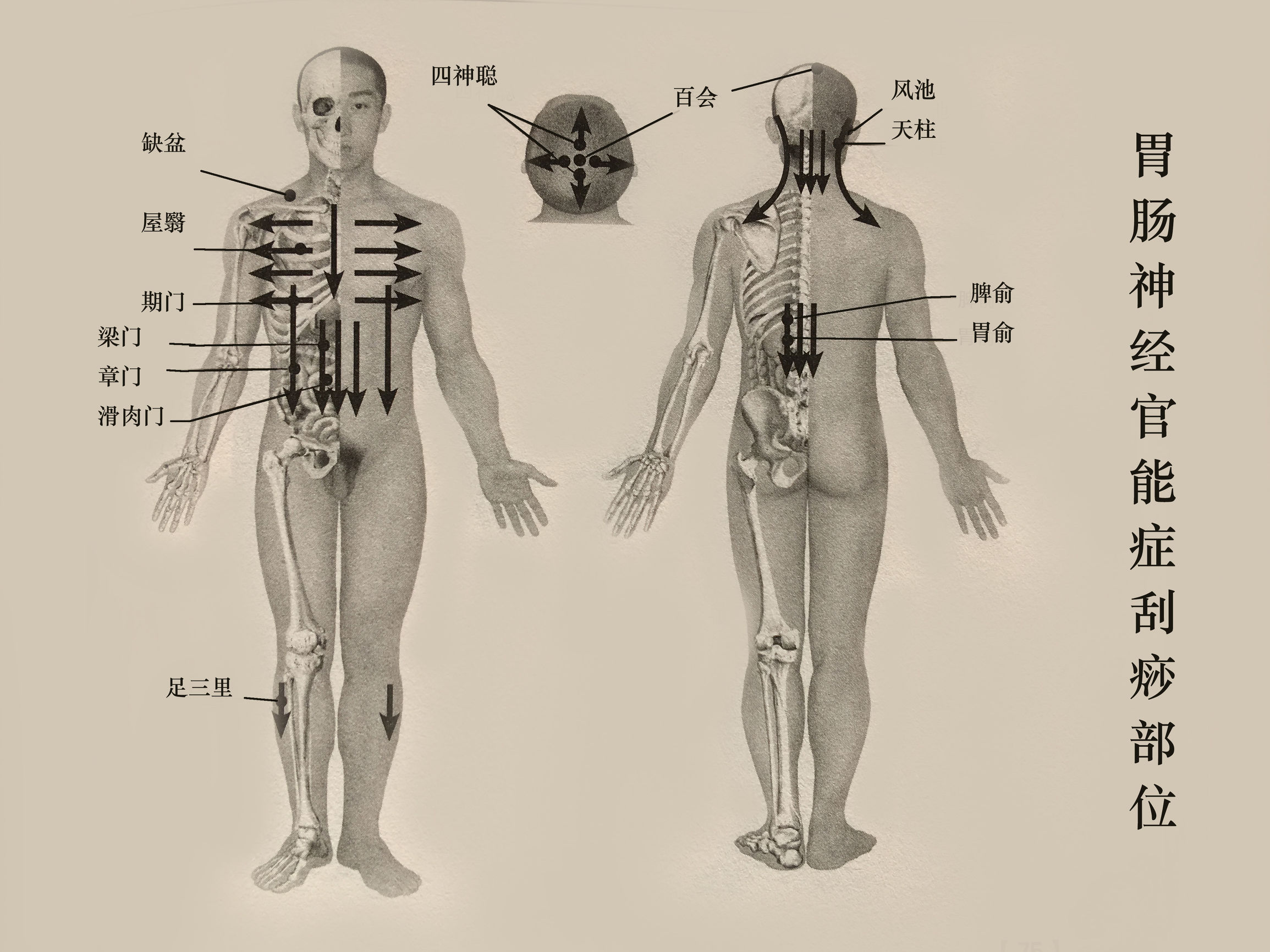 胃肠神经*能官**症、反流性食管炎的刮痧疗法