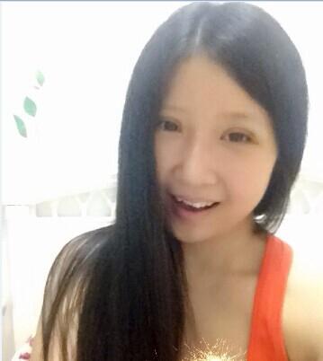 韩式三点双眼皮拆线图片,韩式双眼皮三点好还是五点好