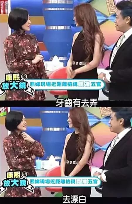 整牙=整容?看杨幂、刘涛、高圆圆为你亲身示范!