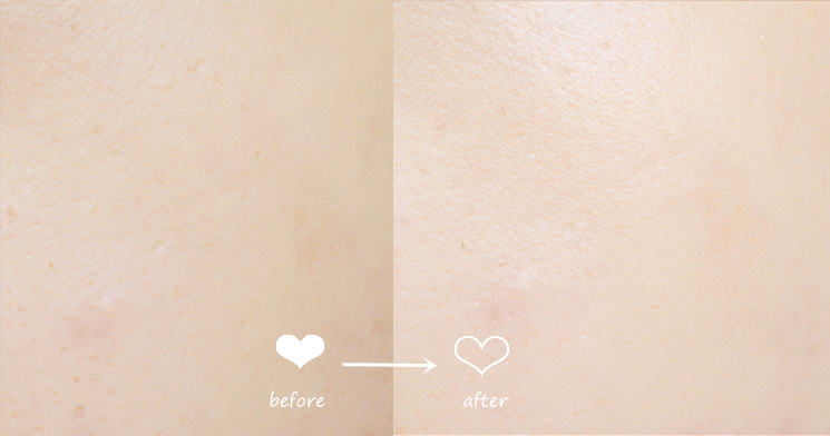 drwu达尔肤面膜干皮,drwu达尔肤面膜伊利莎白