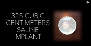 隆过的胸和正常的胸有什么区别,隆过的胸是不是很硬