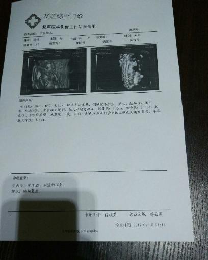 宝宝四维顺利通过腿短,宝宝四维顺利