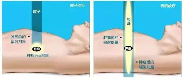 中国的质子中心有几家,全国有几所质子医院哪所最好