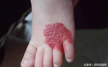 恶性肿瘤身上有很多包是咋回事,恶性肿瘤转移身上很多包块