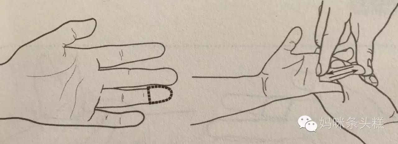 宝宝自汗和盗汗的原因及调理方案,怎么判断宝宝是盗汗还是正常出汗