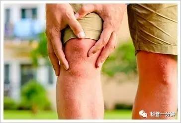 健康科普｜寒冷是关节炎的“元凶”吗？