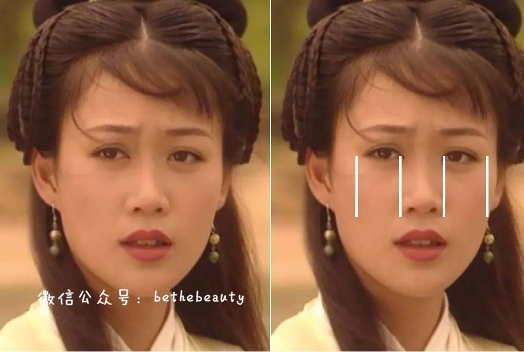 鼻子除了整容变挺还有什么办法,不想整容怎么让鼻子好看