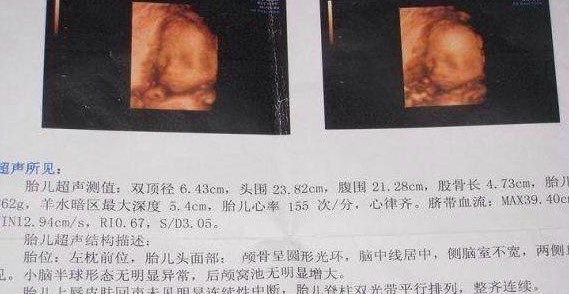 宝宝出生后怎么确定有没有问题,宝宝出生后要28天还是30天