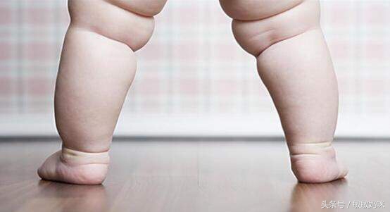 宝宝臀纹或大腿皮纹不对称怎么办,宝宝臀纹腿纹