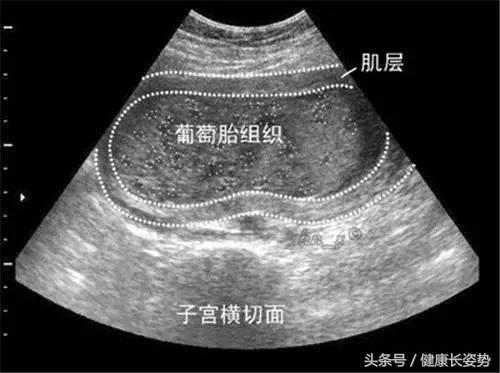 涨知识了但是记不住,涨知识剥洋葱不流泪