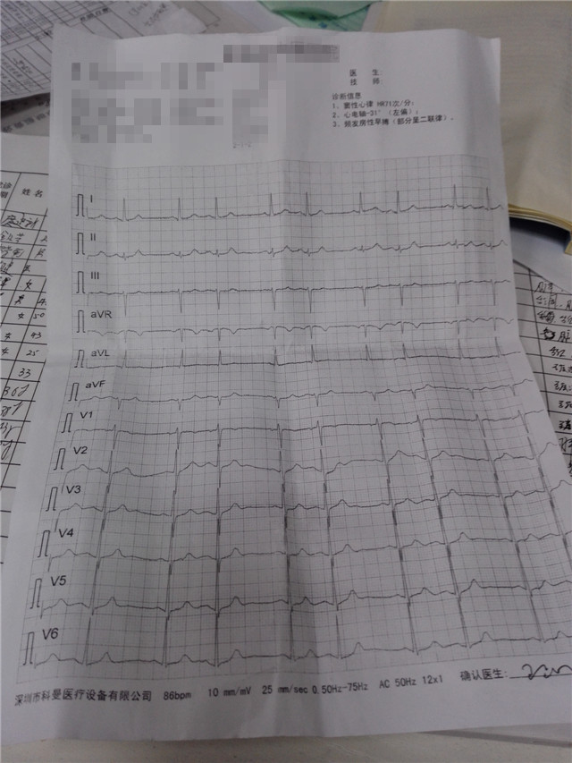 经方加减治疗心悸,张仲景治心律不齐的方剂