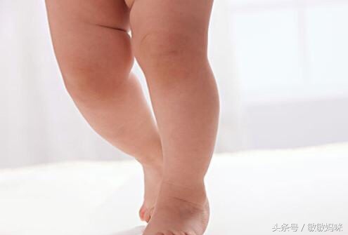 宝宝臀纹或大腿皮纹不对称怎么办,宝宝臀纹腿纹