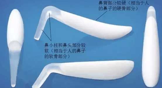 三段式假体隆鼻图片哪家好,进口隆鼻假体三段式