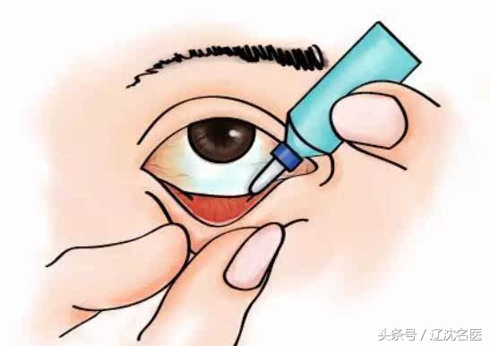 追剧、戴美瞳，女孩上眼皮长满“结石”，医生一针针刺破救眼睛