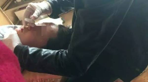 朋友圈内的整形工作室很恐怖，别再被坑了