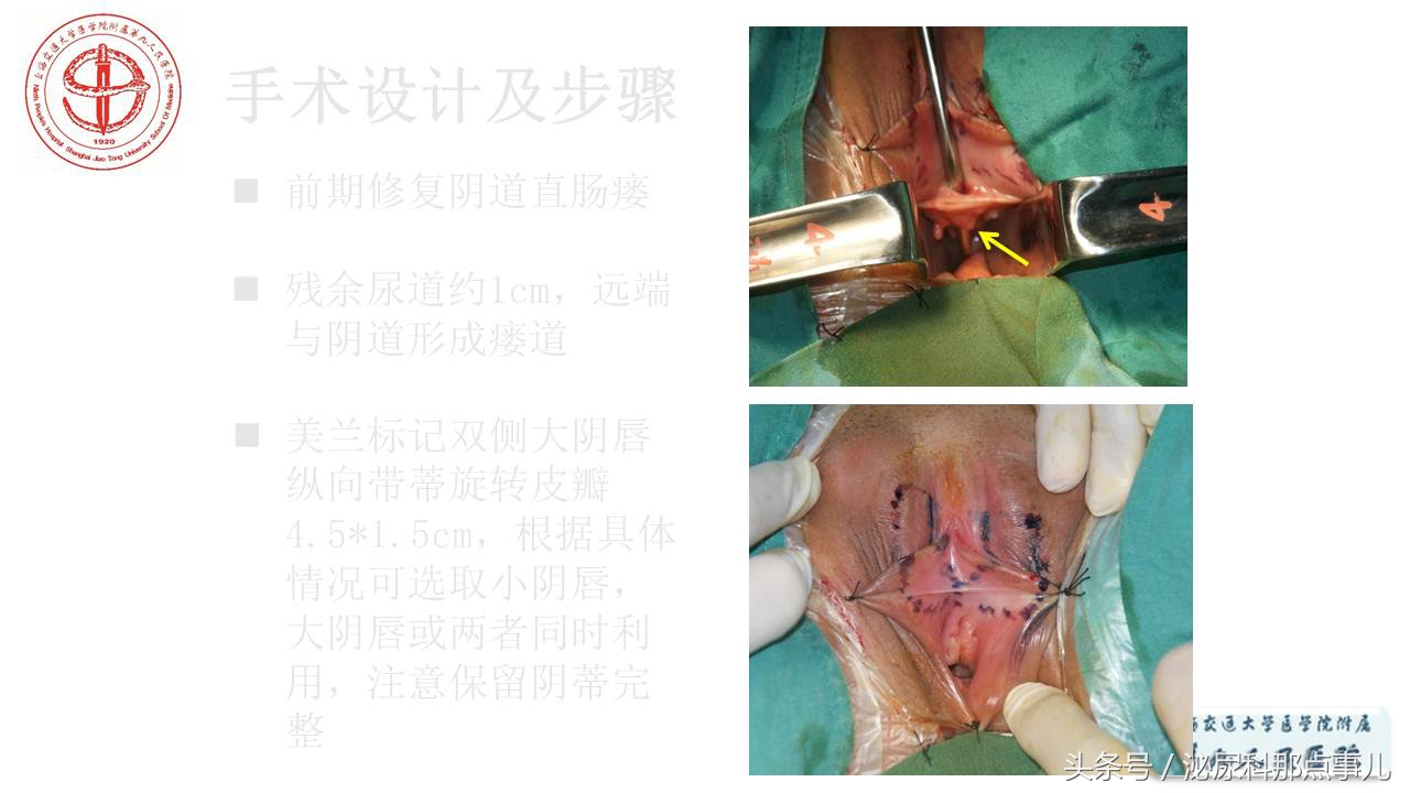 泌尿男科王忠教授,泌尿外科专家王忠教授