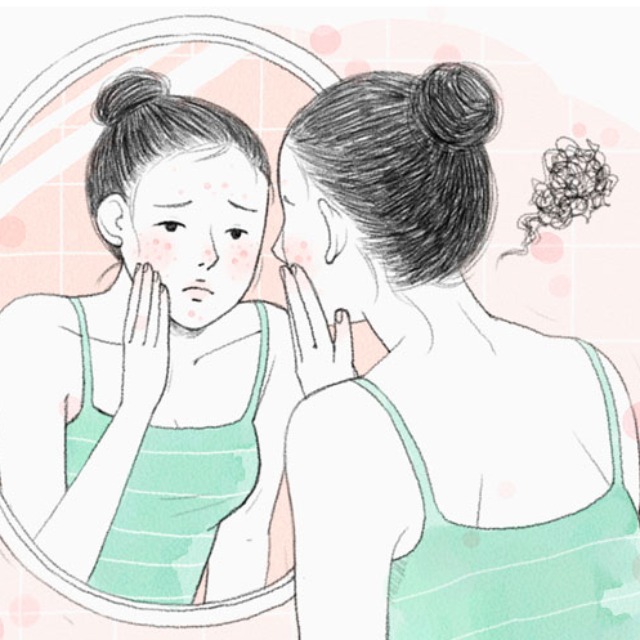 鼻子下巴闭口粉刺怎么去除,闭口粉刺护理全攻略