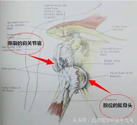 大夫把患者胳膊掰断了怎么赔,医生胳膊酸怎么办