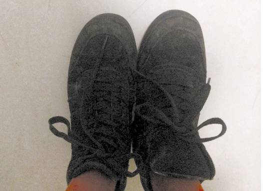 健康美女常穿这种裤,臀部大腿长满红斑!江西很多人穿!